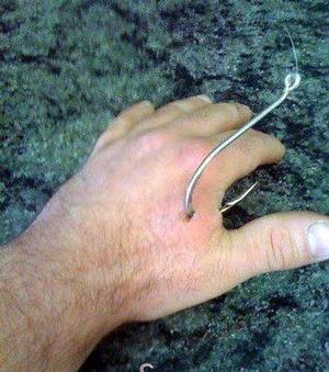 Can anyone share a photo of a fishing hook in their hand or finger?